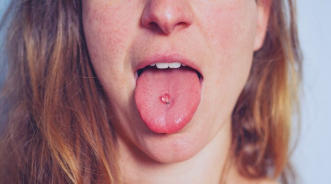 pain in tongue piercing