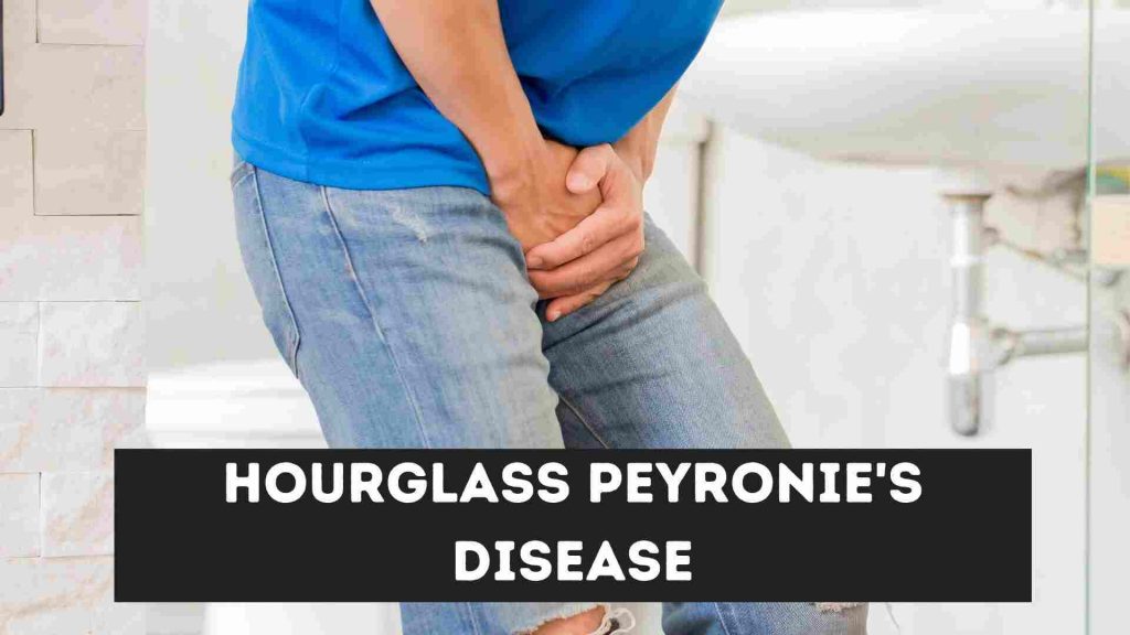Hourglass Peyronie's Disease